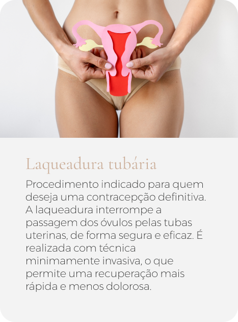 Laqueadura tubária